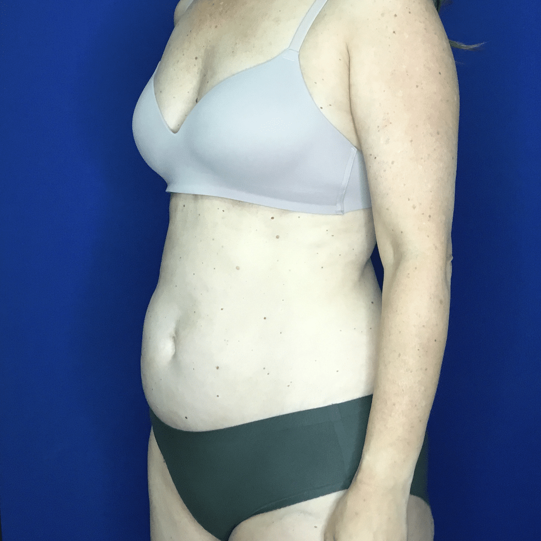 A Woman Wearing Underwear
